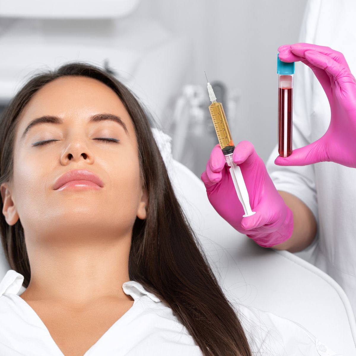 osocze bogatopłytkowe